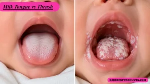 Milk tongue vs thrush in a baby, white coating on the tongue only compared with white patches across the mouth